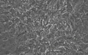 通過直接重新編程制造心肌誘導心肌樣細胞（iCM細胞：induced cardiomyocytes）